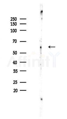NRF1 Recombinant Rabbit mAb - Western blot analysis of lysates from Rat lung, using Nrf1 Recombinant Rabbit mAb at 1/1000 dilution.
