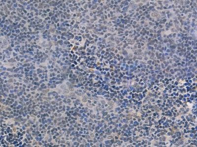 NRF1 Recombinant Rabbit mAb - BF3456 at 1/100 staining human normal tonsil tissue by IHC-P.