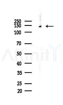 AXL Recombinant Rabbit mAb - Western blot analysis of lysates from Rat muscle, using Axl Recombinant Rabbit mAb at 1/1000 dilution.