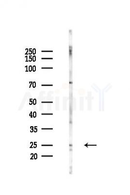 C1QA Recombinant Rabbit mAb - Western blot analysis of lysates from Mouse liver, using C1QA Recombinant Rabbit mAb at 1/1000 dilution.