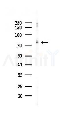 GLUT2 Recombinant Rabbit mAb - Western blot analysis of lysates from B16F10-LUC cells(LPS,4h treatment), using Glucose Transporter GLUT2 Recombinant Rabbit mAb at 1/1000 dilution.