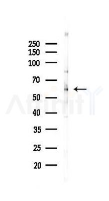 GLUT2 Recombinant Rabbit mAb - Western blot analysis of lysates from Rat lung, using Glucose Transporter GLUT2 Recombinant Rabbit mAb at 1/1000 dilution.