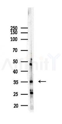 TNNT2 Recombinant Rabbit mAb - Western blot analysis of lysates from Hela cells(LPS,4h treatment), using Cardiac Troponin T Recombinant Rabbit mAb at 1/1000 dilution.