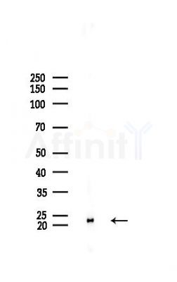 Claudin 11 Recombinant Rabbit mAb - Western blot analysis of lysates from Mouse liver, using Oligodendrocyte Specific Protein Recombinant Rabbit mAb at 1/1000 dilution.