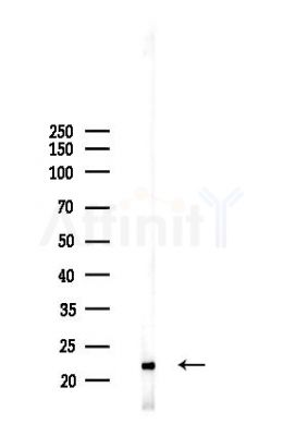Claudin 11 Recombinant Rabbit mAb - Western blot analysis of lysates from A2780 cells(starvation 24h treatment), using Oligodendrocyte Specific Protein Recombinant Rabbit mAb at 1/1000 dilution.