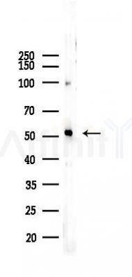 Desmin Recombinant Rabbit mAb - Western blot analysis of lysates from Rat testis, using Desmin Rabbit mAb at 1/1000 dilution.