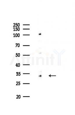 NEK7 Recombinant Rabbit mAb - Western blot analysis of lysates from EC304 cells(LPS,4h treatment), using NEK7 Rabbit mAb at 1/1000 dilution.