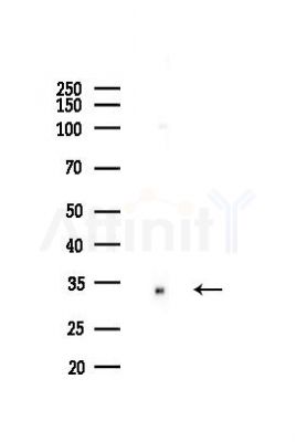 NEK7 Recombinant Rabbit mAb - Western blot analysis of lysates from A375 cells(heat-shock,45min treatment), using NEK7 Rabbit mAb at 1/1000 dilution.