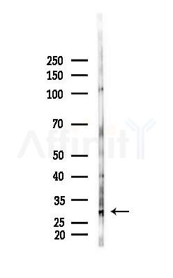 MMP7 Recombinant Rabbit mAb - Western blot analysis of lysates from Mouse lung, using MMP7 Recombinant Rabbit mAb at 1/1000 dilution.