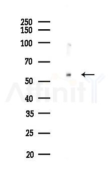 NT5E Recombinant Rabbit mAb - Western blot analysis of lysates from Mouse testis, using CD73 Recombinant Rabbit mAb at 1/1000 dilution.