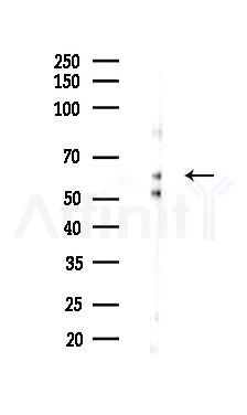 NT5E Recombinant Rabbit mAb - Western blot analysis of lysates from EC304 cells(starvation 24h treatment), using CD73 Recombinant Rabbit mAb at 1/1000 dilution.