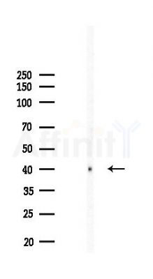ADORA2A Recombinant Rabbit mAb - Western blot analysis of lysates from COLO205 cells(LPS,4h treatment), using Adenosine receptor A2a Recombinant Rabbit mAb at 1/1000 dilution.