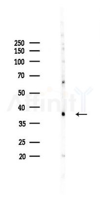 ADORA2A Recombinant Rabbit mAb - Western blot analysis of lysates from HepG2 cells(heat-shock,45min treatment), using Adenosine receptor A2a Recombinant Rabbit mAb at 1/1000 dilution.