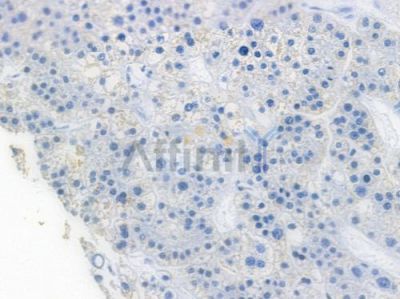 ADORA2A Recombinant Rabbit mAb - BF3471 at 1/100 staining human normal lung tissue by IHC-P.