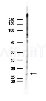 IL1 alpha Recombinant Rabbit mAb - Western blot analysis of lysates from Rat testis, using IL-1 alpha Recombinant Rabbit mAb at 1/1000 dilution.