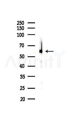 Catalase Recombinant Rabbit mAb - Western blot analysis of lysates from Rat lung, using Catalase Recombinant Rabbit mAb at 1/1000 dilution.