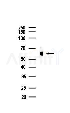 Catalase Recombinant Rabbit mAb - Western blot analysis of lysates from Mouse liver, using Catalase Recombinant Rabbit mAb at 1/1000 dilution.