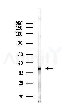 FOLR1 Recombinant Rabbit mAb - Western blot analysis of lysates from Hela cells(LPS 4h treatment), using Folate Binding Protein Recombinant Rabbit mAb at 1/1000 dilution.
