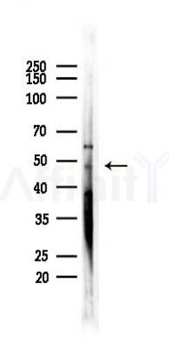 Tryptophan Hydroxylase Recombinant Rabbit mAb - Western blot analysis of lysates from COLO205 cells(UV 30min treatment), using Tryptophan Hydroxylase Recombinant Rabbit mAb at 1/1000 dilution.