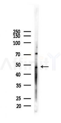 Tryptophan Hydroxylase Recombinant Rabbit mAb - Western blot analysis of lysates from EC304 cells(starvation 24h treatment), using Tryptophan Hydroxylase Recombinant Rabbit mAb at 1/1000 dilution.