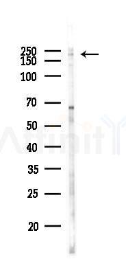 TRPM7 Recombinant Rabbit mAb - Western blot analysis of lysates from K562 cells(UV 30min treatment), using TRPM7 Recombinant Rabbit mAb at 1/1000 dilution.