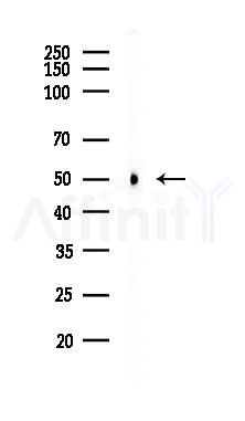 WTAP Recombinant Rabbit mAb - Western blot analysis of lysates from A375 cells(heat-shock,45min treatment), using WTAP Recombinant Rabbit mAb at 1/1000 dilution.