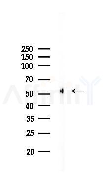 WTAP Recombinant Rabbit mAb - Western blot analysis of lysates from COLO205 cells(LPS, 4h treatment), using WTAP Recombinant Rabbit mAb at 1/1000 dilution.