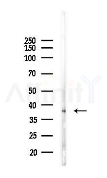 Cathepsin B Recombinant Rabbit mAb - Western blot analysis of lysates from Hela cells(LPS, 4h treatment), using Cathepsin B Recombinant Rabbit mAb at 1/1000 dilution.