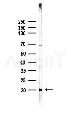 Calmodulin Recombinant Rabbit mAb - Western blot analysis of lysates from HUVEC cells(LPS,4h treatment), using Calmodulin Recombinant Rabbit mAb at 1/1000 dilution.