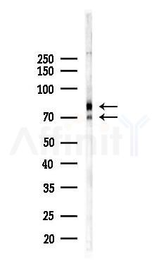 IL6R Recombinant Rabbit mAb - Western blot analysis of lysates from EC304 cells(heat-shock,45min treatment), using IL-6R Recombinant Rabbit mAb at 1/1000 dilution.