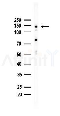 FGFR3 Recombinant Rabbit mAb - Western blot analysis of lysates from HUVEC cells(LPS,4h treatment), using FGFR3 Recombinant Rabbit mAb at 1/1000 dilution.