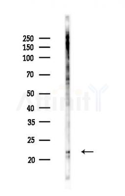 KRAS Recombinant Rabbit mAb - Western blot analysis of lysates from Hela cells(LPS,4h treatment), using KRAS Recombinant Rabbit mAb at 1/1000 dilution.
