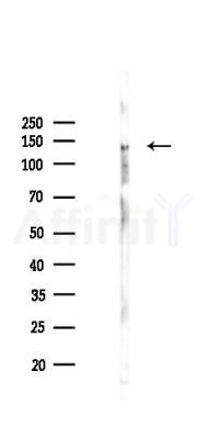 CD130/gp130 Recombinant Rabbit mAb - Western blot analysis of lysates from PC12 cells(LPS 4h treatment), using CD130 Recombinant Rabbit mAb at 1/1000 dilution.