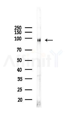 Insulin Receptor beta Recombinant Rabbit mAb - Western blot analysis of lysates from RAW264.