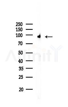 Insulin Receptor beta Recombinant Rabbit mAb - Western blot analysis of lysates from Mouse brain, using Insulin Receptor beta Recombinant Rabbit mAb at 1/1000 dilution.