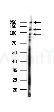 IGF-I receptor beta/Insulin Receptor beta Recombinant Rabbit mAb - Western blot analysis of lysates from Rat lung, using IGF-I receptor beta/Insulin Receptor beta Recombinant Rabbit mAb at 1/1000 dilution.