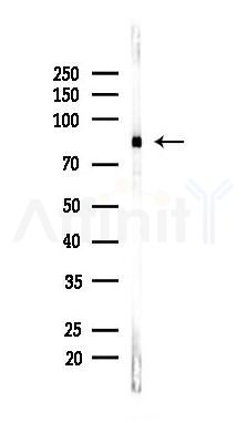 PKC alpha Recombinant Rabbit mAb - Western blot analysis of lysates from HUVEC cells(LPS,4h treatment), using PKC alpha Recombinant Rabbit mAb at 1/1000 dilution.