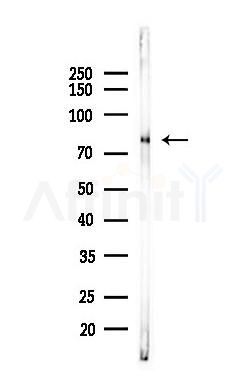 PKC alpha Recombinant Rabbit mAb - Western blot analysis of lysates from B16F10-LUC cells(LPS,4h treatment), using PKC alpha Recombinant Rabbit mAb at 1/1000 dilution.