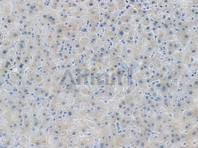 PKC alpha Recombinant Rabbit mAb - BF3505 at 1/100 staining human normal liver tissue by IHC-P.