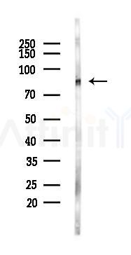 Phospho-PKC (Ser660) Recombinant Rabbit mAb - Western blot analysis of lysates from Rat muscle, using Phospho-PKC (Ser660) Recombinant Rabbit mAb at 1/1000 dilution.