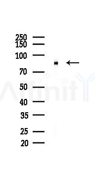 Phospho-PKC (Ser660) Recombinant Rabbit mAb - Western blot analysis of lysates from Mouse brain, using Phospho-PKC (Ser660) Recombinant Rabbit mAb at 1/1000 dilution.