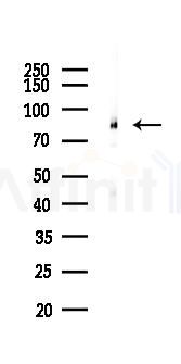 Phospho-PKC (Ser660) Recombinant Rabbit mAb - Western blot analysis of lysates from EC304 cells(LPS, 4h treatment), using Phospho-PKC (Ser660) Recombinant Rabbit mAb at 1/1000 dilution.