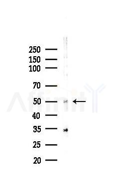 ANGPTL4 Recombinant Rabbit mAb - Western blot analysis of lysates from HUVEC cells(LPS,4h treatment), using Angiopoietin-like 4 Recombinant Rabbit mAb at 1/1000 dilution.