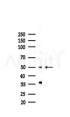 ANGPTL4 Recombinant Rabbit mAb - Western blot analysis of lysates from COLO205 cells(heat-shock,45min treatment), using Angiopoietin-like 4 Recombinant Rabbit mAb at 1/1000 dilution.