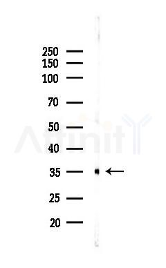 HLA-DRA Recombinant Rabbit mAb - Western blot analysis of lysates from Rat lung, using HLA-DR Recombinant Rabbit mAb at 1/1000 dilution.