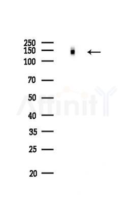 Integrin  alpha V Recombinant Rabbit mAb - Western blot analysis of lysates from EC304 cells(LPS,4h treatment), using Integrin alpha V Rabbit mAb at 1/1000 dilution.