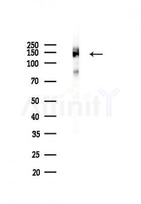 Integrin  alpha V Recombinant Rabbit mAb - Western blot analysis of lysates from A375 cells(heat-shock,45min treatment), using Integrin alpha V Rabbit mAb at 1/1000 dilution.