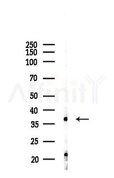 FRA1 Recombinant Rabbit mAb - Western blot analysis of lysates from PC12 cells(LPS, 4h treatment), using FRA1 Recombinant Rabbit mAb at 1/1000 dilution.
