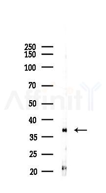 FRA1 Recombinant Rabbit mAb - Western blot analysis of lysates from B16F10-LUC cells(starvation,24h treatment), using FRA1 Recombinant Rabbit mAb at 1/1000 dilution.
