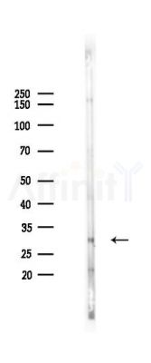 SLC7A5 Recombinant Rabbit mAb - Western blot analysis of lysates from Hela cells(heat-shock 45min treatment), using SLC7A5 Recombinant Rabbit mAb at 1/1000 dilution.